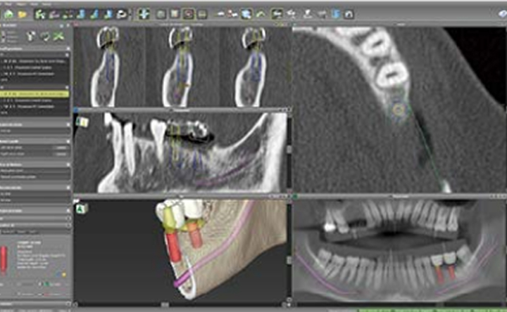 精密な診査・設計